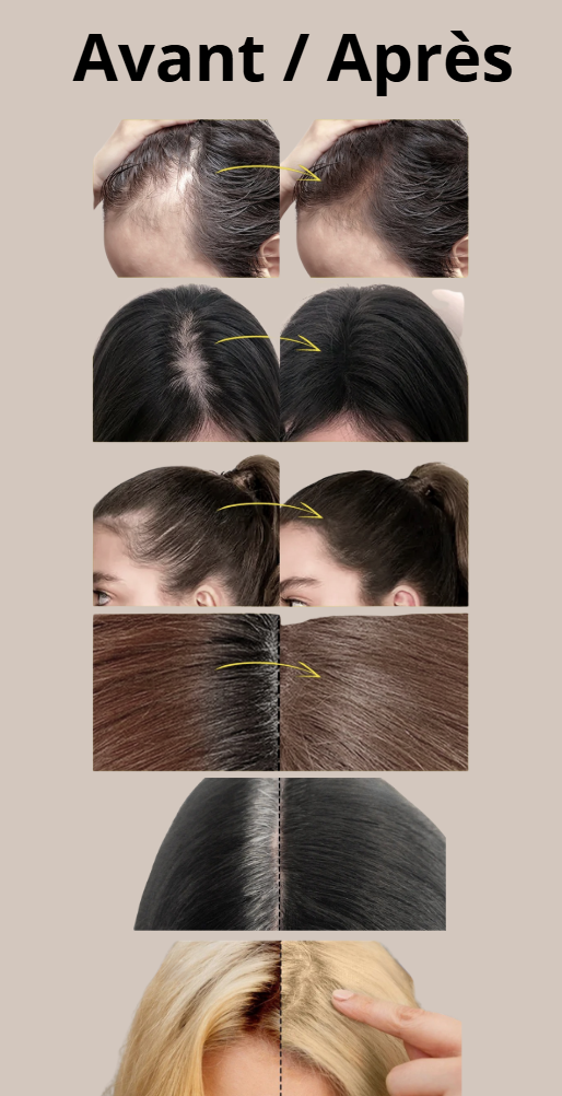 Hairfusion - SEVICHY™